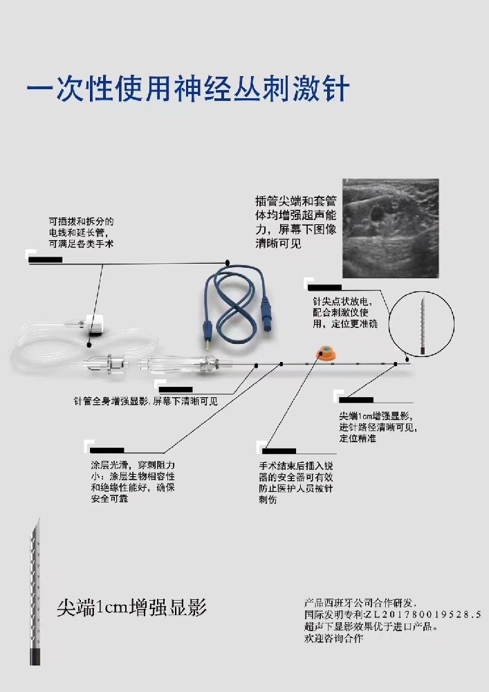 神經叢刺激針的治療過程是怎樣的？